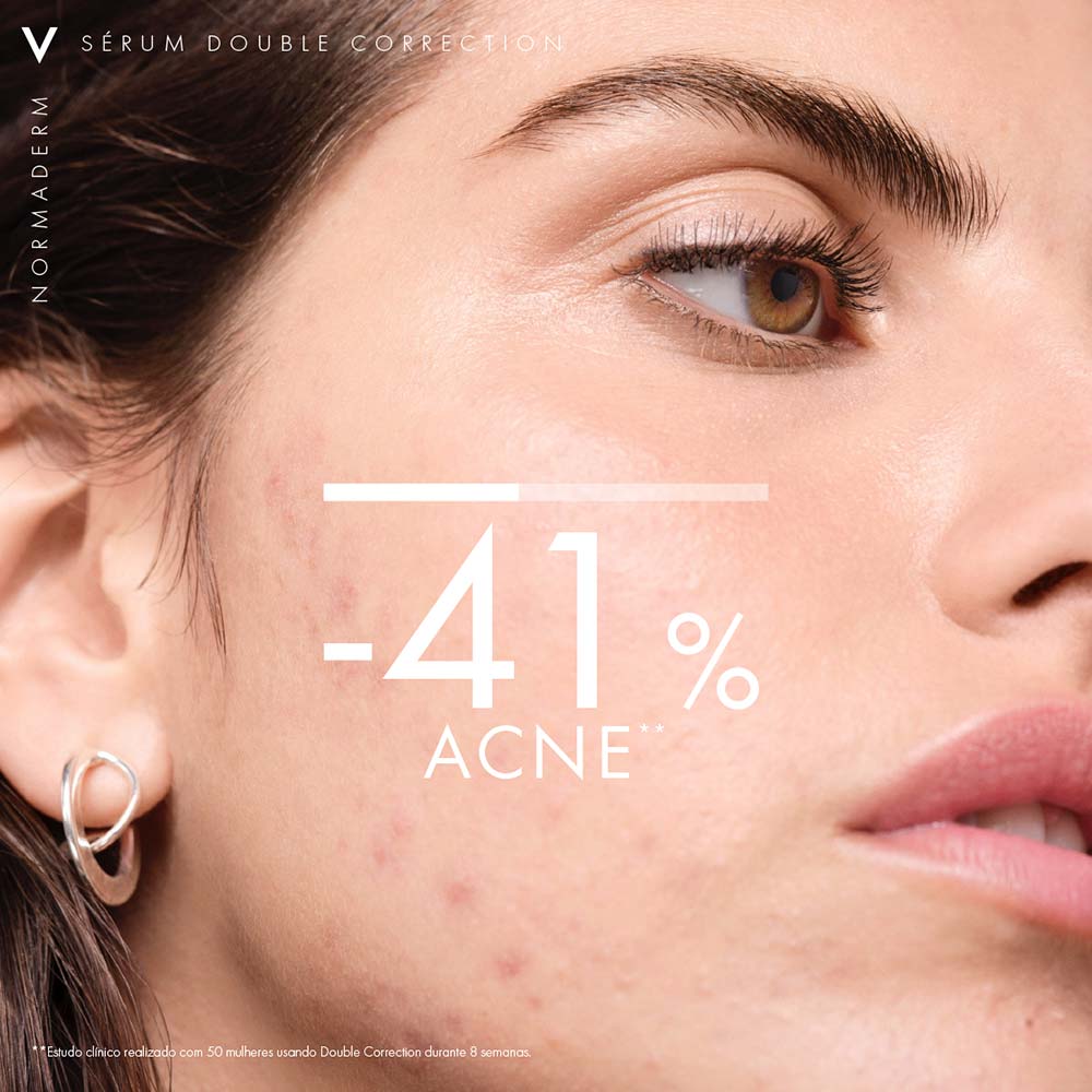 https://epocacosmeticos.vteximg.com.br/arquivos/ids/559384/serum-antioleosidade-e-antiacne-vichy-normaderm-phytosolution--5-.jpg?v=638241736527170000