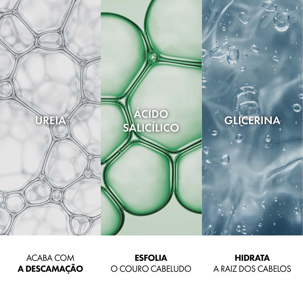 https://epocacosmeticos.vteximg.com.br/arquivos/ids/583655/vichy-dercos-shampoo--6-.jpg?v=638374040448200000